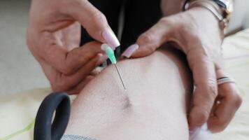 A needle inserted into a vein on the forearm during a medical procedure, held by hands with long manicured nails, showing precision and confidence in care video