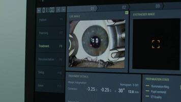 Ophthalmic surgery. View on the screen of medical monitor in operating room. Lasik 4 video