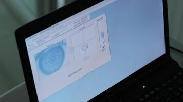 Ophthalmic surgery. View on the screen of medical monitor in operating room. Lasik video