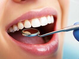 Dental checkup taking place in a clinic with bright lighting photo
