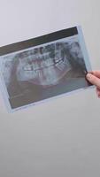 Dentist holds X-ray image and evaluates the condition of the patient's teeth for diagnosis and treatment. video