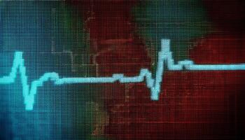 Heartbeat Graphic Displayed on a Digital Screen With Vibrant Colors Indicating Health Data Trends and Monitoring Changes photo