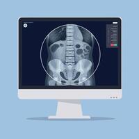 Detailed medical illustration of a spine and pelvis on a flat design computer screen art vector