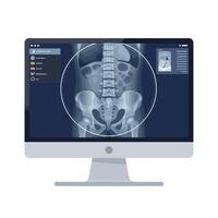Digital illustration of an X-ray display on a computer monitor in a minimal style art vector