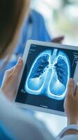Medical X-Ray of Lungs on Tablet photo
