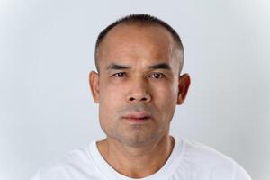 The man has facial swelling due to an allergic reaction to triggers such as insect bites stings.6 photo