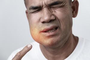 The man has facial swelling due to an allergic reaction to triggers such as insect bites stings.7 photo