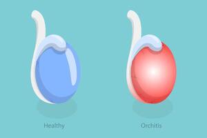 3D Isometric Flat Conceptual Illustration of Orchitis, Inflammation of Testes vector