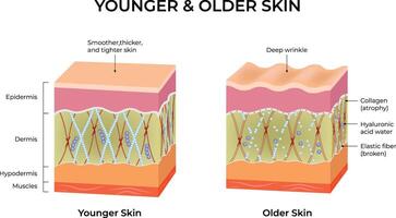 Comparison of Younger and Older Skin Structures and Aging Effects Illustration vector