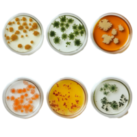 Diverse bacterial colonies cultured in petri dishes display unique characteristics and colors in a laboratory setting, Different types of bacterial colonies in petri dish over transparent background png