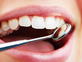 Dental checkup with mirror tool highlighting healthy teeth photo
