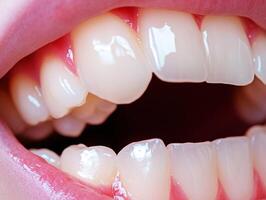 Healthy teeth on display in a close-up view of an open mouth photo