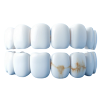 A 3D realistic set featuring one row of clean shiny teeth and another row of stained dirty teeth png
