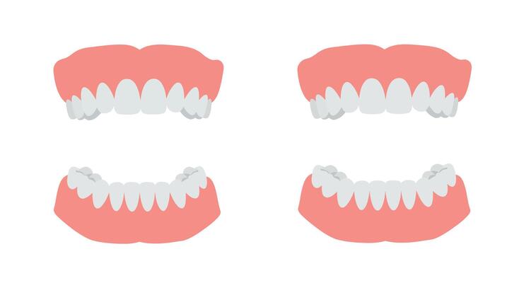 Dental illustrations showing upper and lower teeth in minimal art style illustration