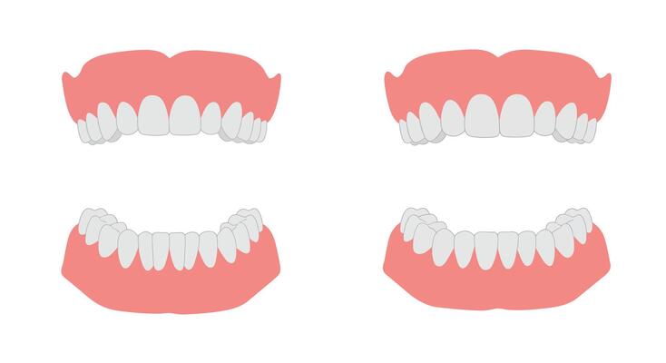 Dental health illustration showing upper and lower teeth in flat art