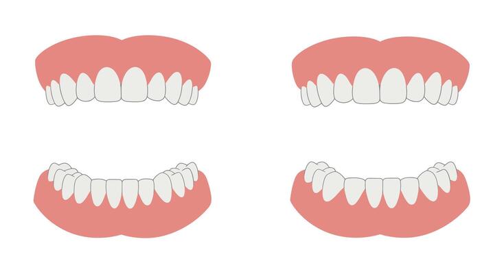 Detailed illustration of teeth alignment changes in flat art