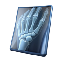 impressive memorable X-ray film showing a fracturebone, detailemedical imagery, backlit, front view, isolateon transparent background,high-resolution product photography png