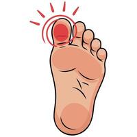 Swollen stubbed toe injury isolated illustration on white background vector