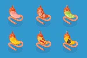 3D Isometric Flat Set of Stomach Problems, Digestive System Issues vector