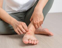 A person with a visible red rash on their foot, scratching it due to itchiness, symbolizing common skin problems photo