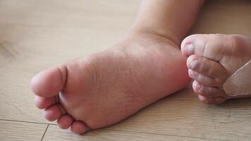 Child's foot with bandage resting on the floor at home video