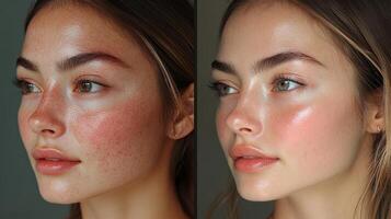 Skin transformation before and after showcasing natural beauty without heavy makeup in a close-up portrait photo