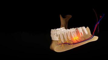 Toothache. Anatomical detailed section of the teeth. Nerve inflammation. 3D animation 5 video