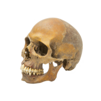 A weathered human skull with visible teeth and cracks, showcasing aged appearance, isolated transparency background. skull texture and color suggest historical significance or archaeological png