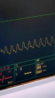 A monitor with an ecg graph on it video