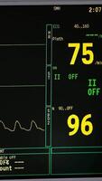 A monitor displaying the number of heart beats video