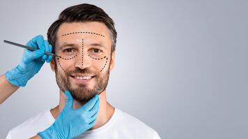 Handsome man with pencil marks on skin for cosmetic surgery, ready for operation. Aesthetic Cosmetology concept. Plastic surgeon applying marks on smiling man face before surgery, grey background photo