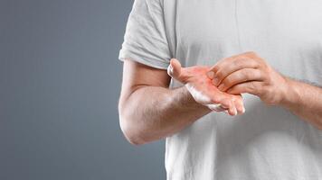 Annoyed middle aged bearded man scratching his red palm on grey studio background, copy space. Caucasian man suffering from allergic reaction, psoriasis or eczema, having itchy hands photo