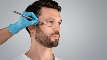 Handsome man with pencil marks under eyes for cosmetic surgery or correction, ready for operation. Plastic Surgery concept. Plastic surgeon applying marks on man face before surgery, grey background photo