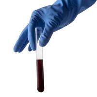 A hand holding a test tube with blood in it photo