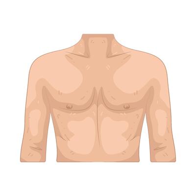 Illustration of Chest