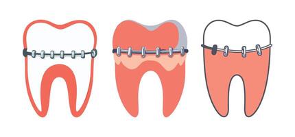 Abstract teeth with different types of braces Icon or Logo Design Template vector