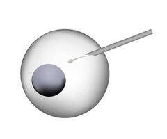 Artificial insemination injecting sperm into female egg cell vector