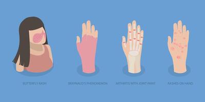 3D Isometric Flat Illustration of Systemic Lupus Erythematosus, Butterfly Rash Red Patches vector