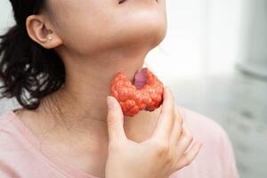 Hyperthyroidism, Overactive Thyroid, Thyroid Lymphoma, Asian woman with thyroid photo
