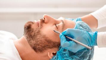 Handsome man getting pencil marks under eyes before cosmetic surgery or correction, ready for operation. Plastic surgeon applying marks on man face before surgery at aesthetic clinic, side view photo