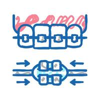 work process tooth braces icon doodle illustration vector