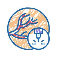 removal of vascular pathologies icon doodle illustration vector
