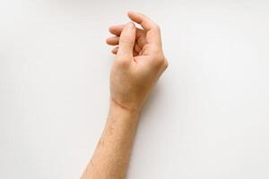 Scratched hand on a white background, top view. Skin scratches from a cat photo