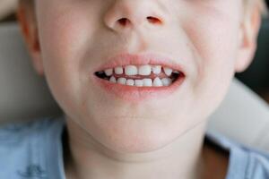 Child with Mixed Teeth Smiling Casually photo