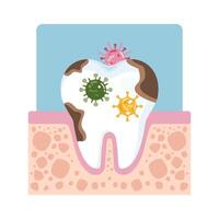 Decaying tooth with bacteria and germs. Dental problem, infection, and poor hygiene concept. vector