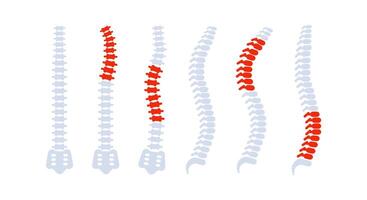 Spine bones with back pain highlighted showing different problems vector