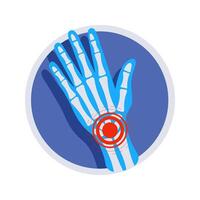 X ray of a hand showing wrist pain inside a circle vector