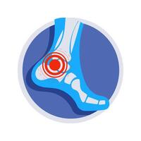 X ray showing ankle pain and inflammation inside a circle vector