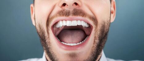 Man smiling widely with open mouth for expression photo