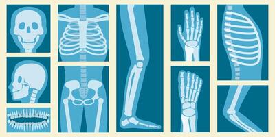 3D Isometric Flat Set of XRay Of Human Body Parts, Skeleton and Bones Scan vector